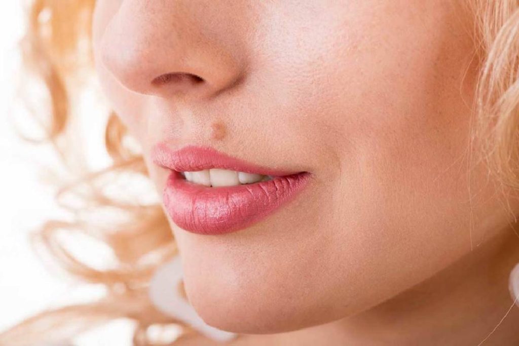 Can Beauty Marks Grow? Description, Types and More 2022