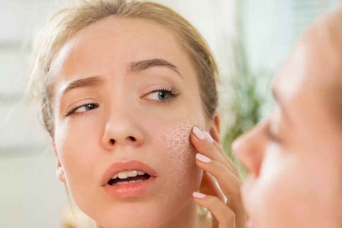 Dry skin