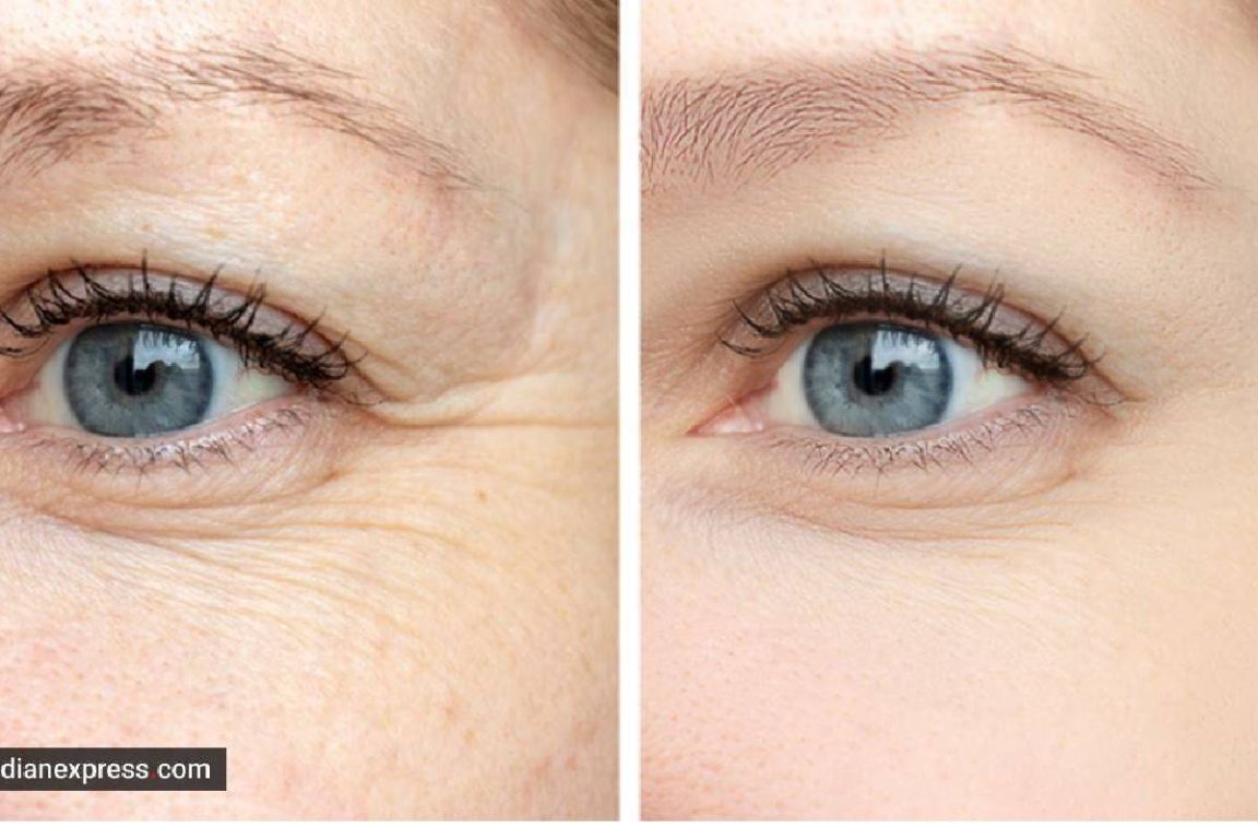 Prevent Wrinkles