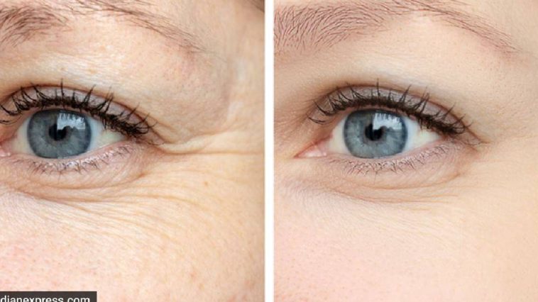 Prevent Wrinkles