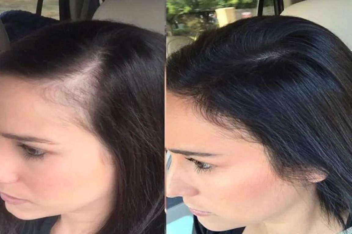 Thinning hair to strong hair