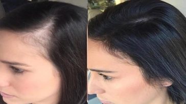 Thinning hair to strong hair