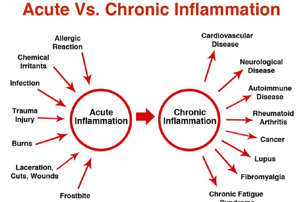 Types Of Inflammation Definition Types And More 2022 types-of-inflammation-definition-types-and-more-2022