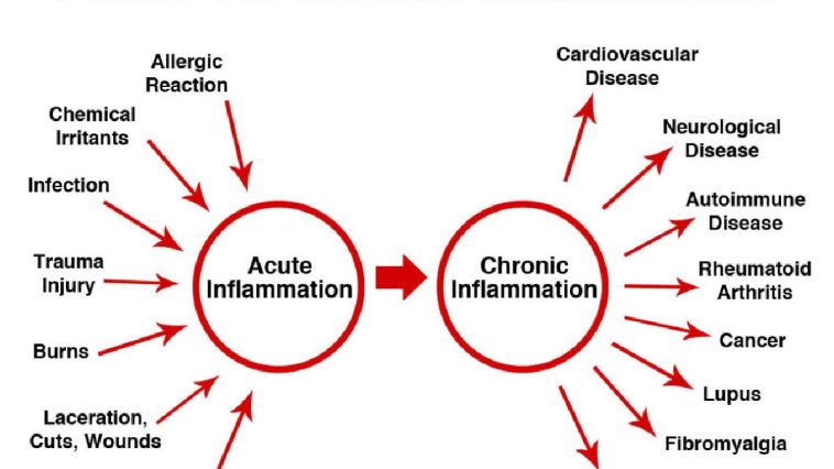 Types of inflammation