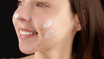 Moisturizer for Acne prone skin
