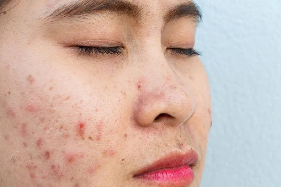 Skin allergy