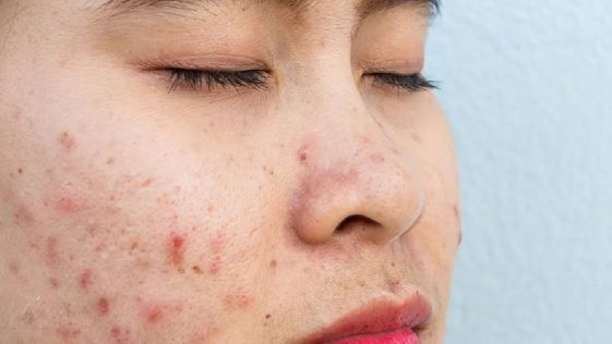 Skin allergy