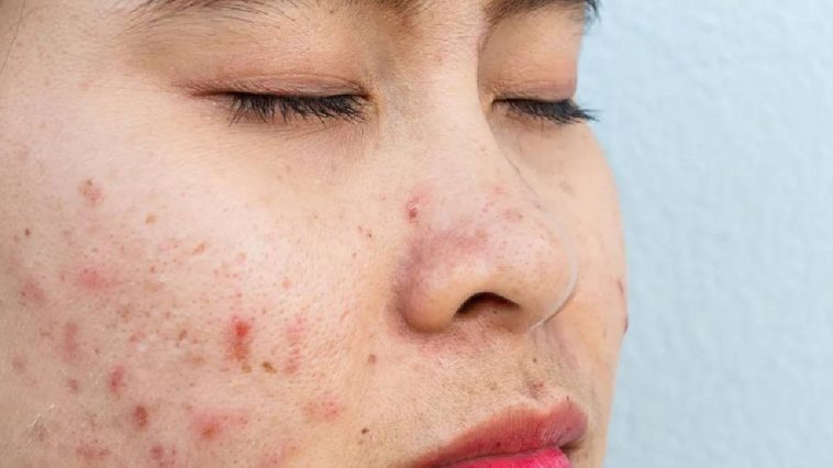Skin allergy